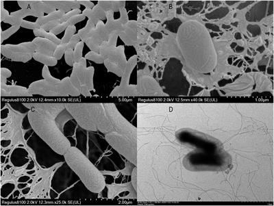 Fungus Pichia kudriavzevii XTY1 and heterotrophic nitrifying bacterium Enterobacter asburiae GS2 cannot efficiently transform organic nitrogen via hydroxylamine and nitrite